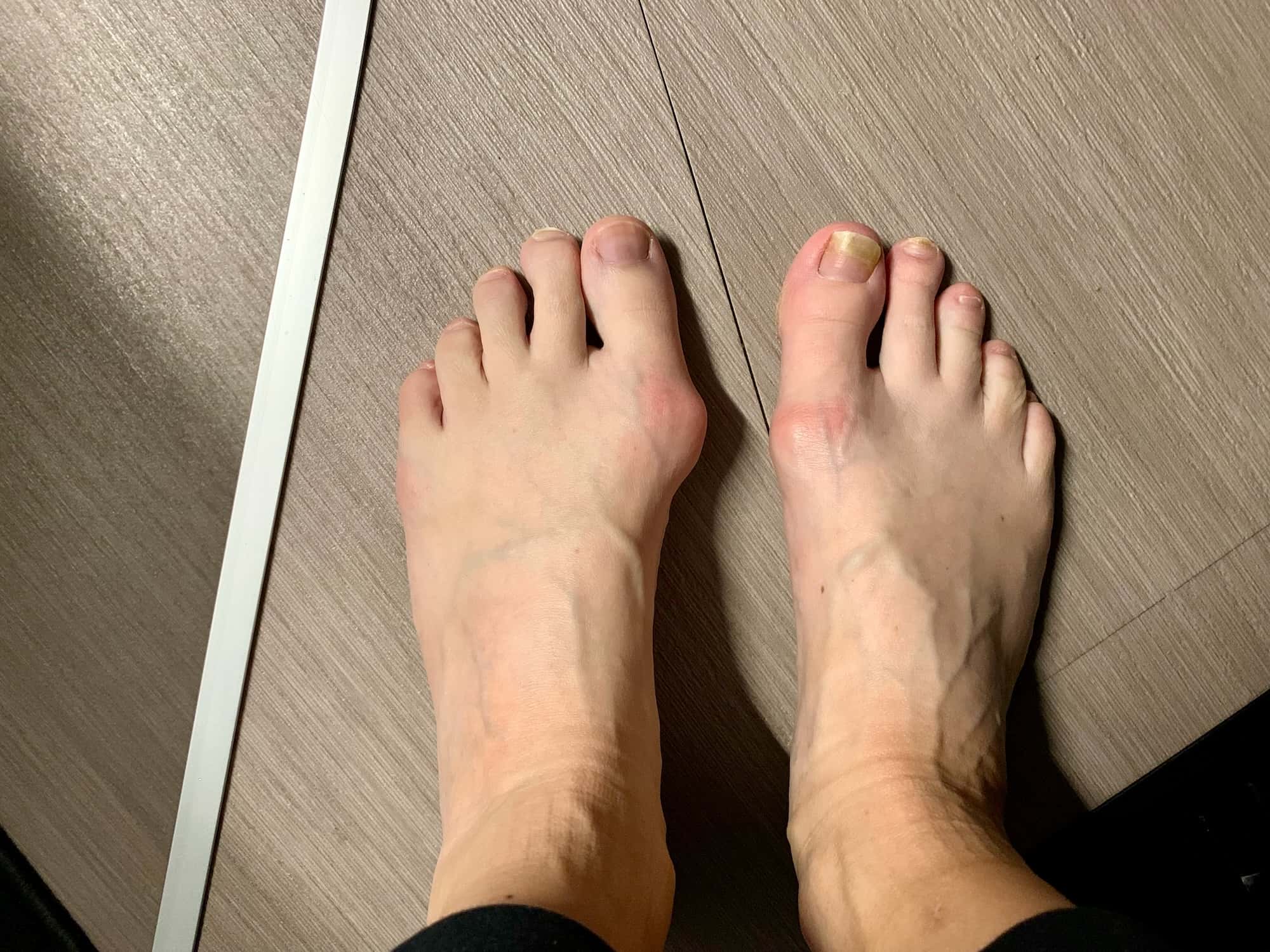 Souvenir photo of two rather crooked feet